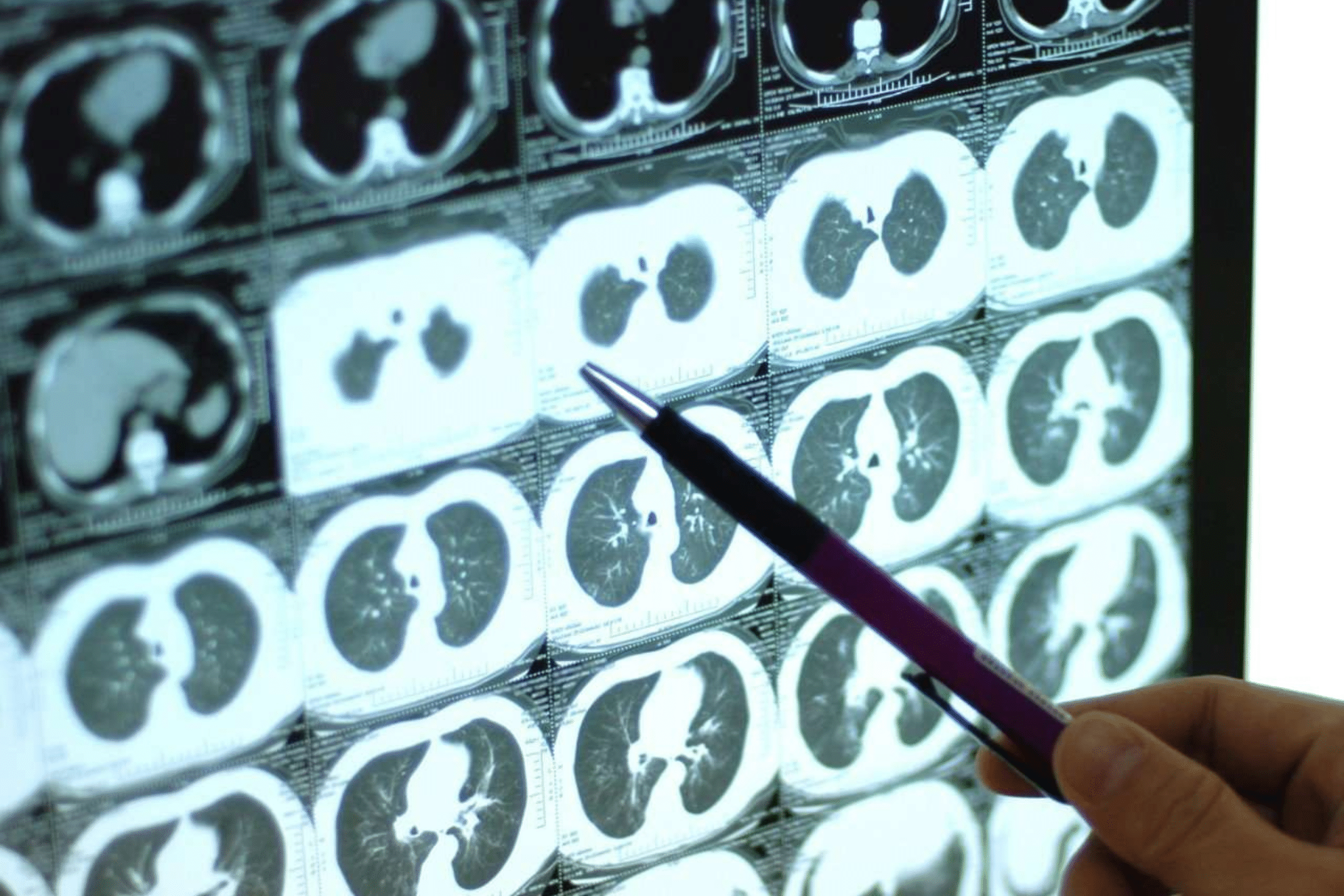 image of a scan picture